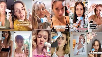 Se supo la increíble cifra que ganaron las famosas con la maquinita facial