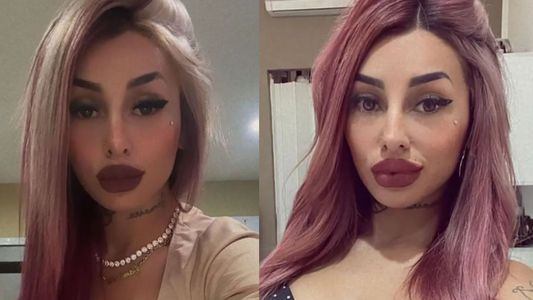 Tamara Báez reveló cuál es la cirugía estética que se realizará tras dejar de amamantar