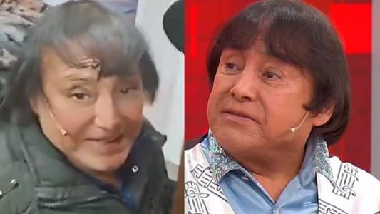 El video de Ricky Maravilla que se volvió viral por su supuesta nueva cara: la explicación del cantante