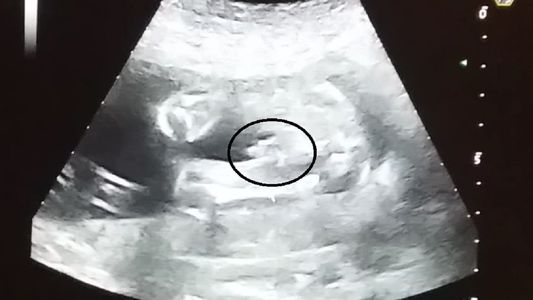 El polémico nombre que le pondrá a su hijo un ex participante de Combate