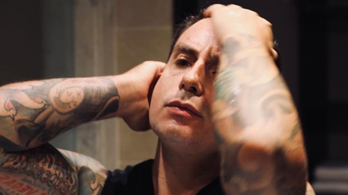 Fede Bal mostró las marcas en su brazo tras el accidente y operación en Brasil