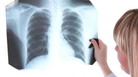 Aumentaron los casos de tuberculosis en Catamarca: ¿qué es esta enfermedad, cómo se transmite y cuáles son sus síntomas?