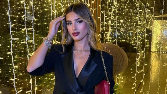 Julieta Poggio mostró las impactantes heridas que le dejó un terrible accidente