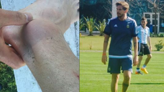 Sebastián Vignolo: Provoqué en jugar sin canilleras y medias bajas