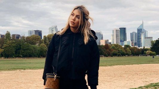 La imagen de Wanda Nara que desató el debate: ¿se hizo un retoque estético en el rostro?