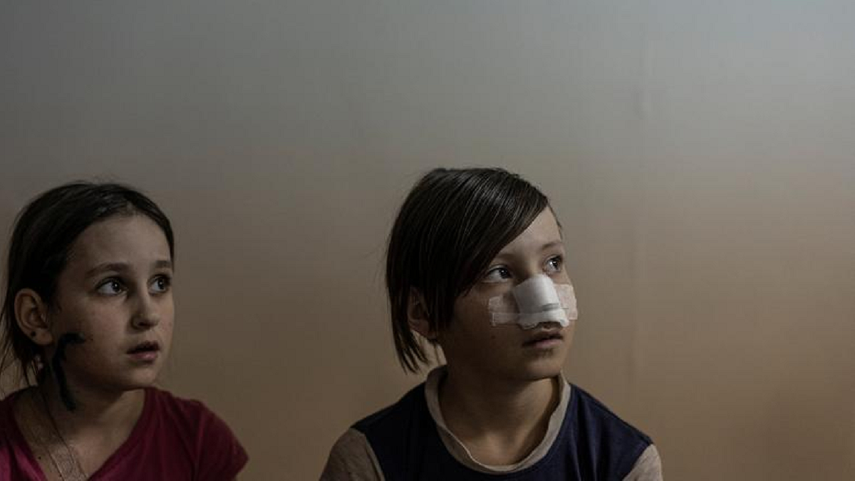 Niños en Ucrania: Milana y Sasha, heridas durante un bombardeo a la ciudad de Mariúpol se atienden el hospital pediátrico de Zaporizhzhia (Foto: agencia REUTERS/Marko Djurica)