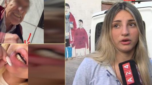 Me pegó en la cara: el video del brutal ataque de un vecino a una chica por su mal estacionamiento