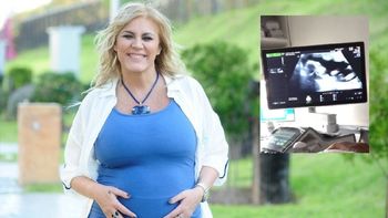 Débora DAmato presentó a Lola a través de una ecografía