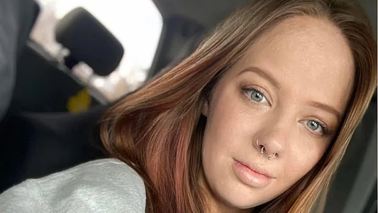 Se quemó el 40% de su cuerpo: renació y hoy Abigail comparte sus fotos del antes y después