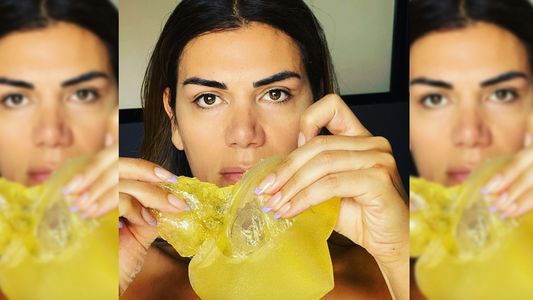 Florencia de la V tuvo que ser operada por una fisura en su prótesis mamaria