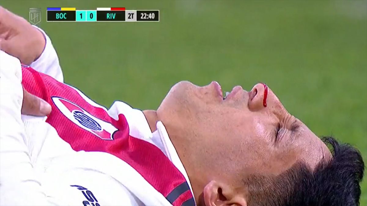 Así fue el tremendo golpe que sufrió Rodrigo Aliendro en el Superclásico. (Foto: captura TV)