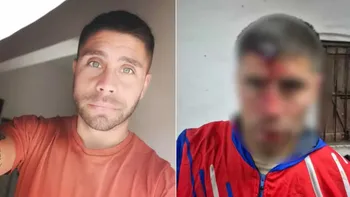 Dieron el alta al hombre que fue apuñalado en la cabeza con una llave de auto