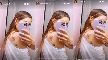 Mica Tinelli comenzó a quitarse los tatuajes que la avergüenzan