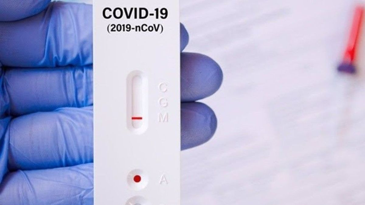 Coronavirus: los contagios siguen en descenso y reportan un 21