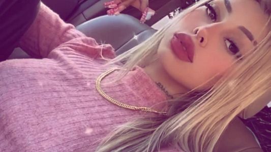 Adicta a los retoques estéticos, Tamara Báez mostró su nueva boca