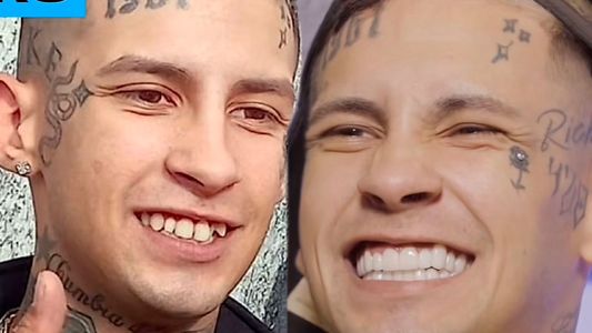 L-Gante explicó por qué se hizo los dientes en Colombia y no en la Argentina