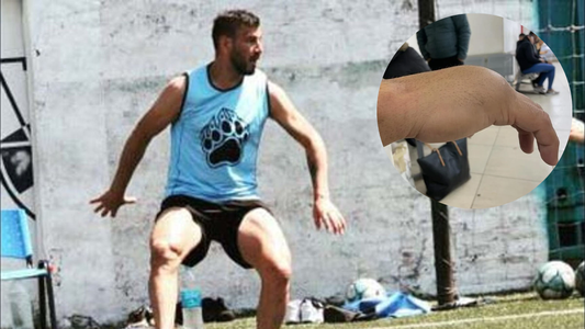 Un futbolista denunció haber sido agredido por dirigentes: terminó detenido y con su muñeca fracturada