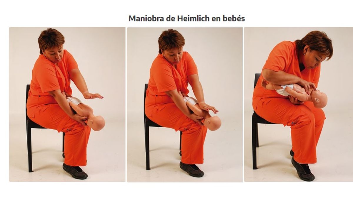 Se recomienda que la maniobra de Heimlich debe utilizarse s&oacute;lo en caso de una obstrucci&oacute;n grave de la v&iacute;a a&eacute;rea.&nbsp;