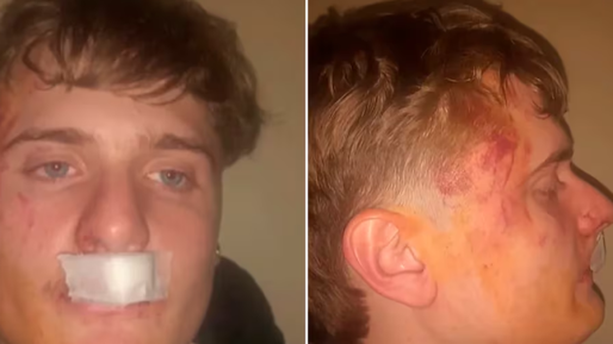Brutal ataque de un grupo de rugbiers a un joven en una fiesta en Zárate: Pudo ser como Fernando Báez Sosa (Foto: A24).