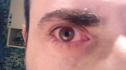 Empecé a ver todo verde: la historia viral educativa para ayudar a detectar un desprendimiento de retina