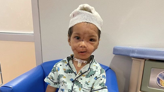 Las 16 cirugías que le salvaron la vida al niño de 22 meses atacado por un perro