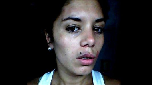 Aparecieron fotos de la ex del Polaco con moretones