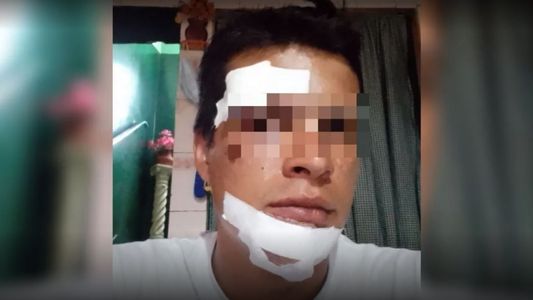 Su novia lo atacó con un ladrillo y dice que no le tomaron la denuncia