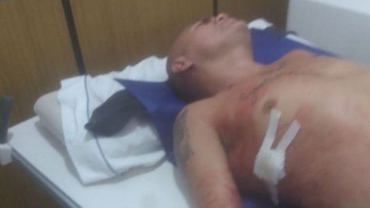 Apuñalan al ex boxeador Rodrigo La Hiena Barrios tras una pelea en una fiesta