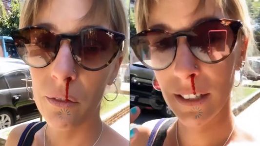 Violento asalto a Dani La Chepi: fue golpeada por un delincuente que quiso robarle el celular