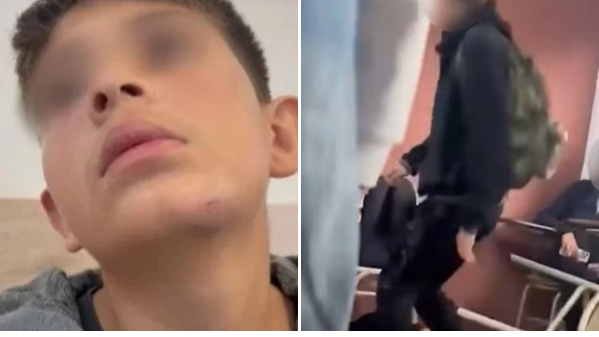 Salvaje golpiza a un alumno de 14 años dentro de una escuela