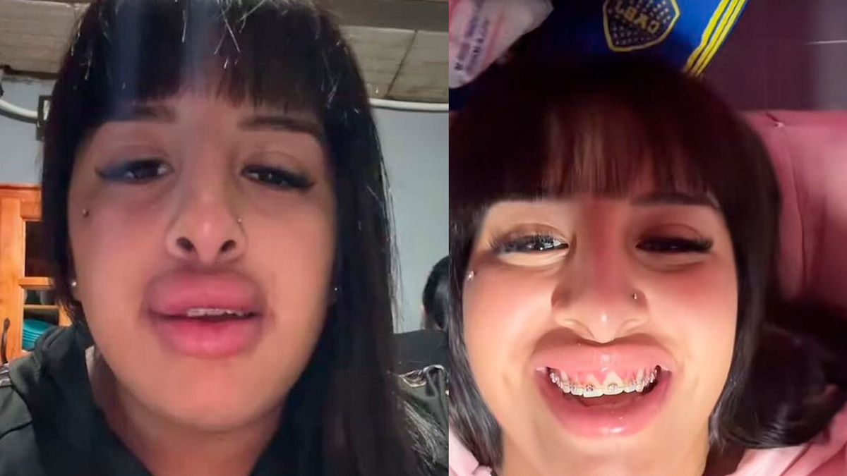 A la Coqueta se le escapó un detalle más del escándalo viral de la inyección de ácido hialurónico que le puso una lashista y explotó todo