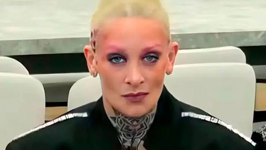 El complejo trastorno psiquiátrico que sufre la hermana de Furia de Gran Hermano