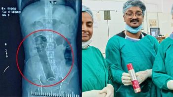 El doctor Arindam Ghosh fue el responsable de la compleja cirugía en la India (Foto: News18).
