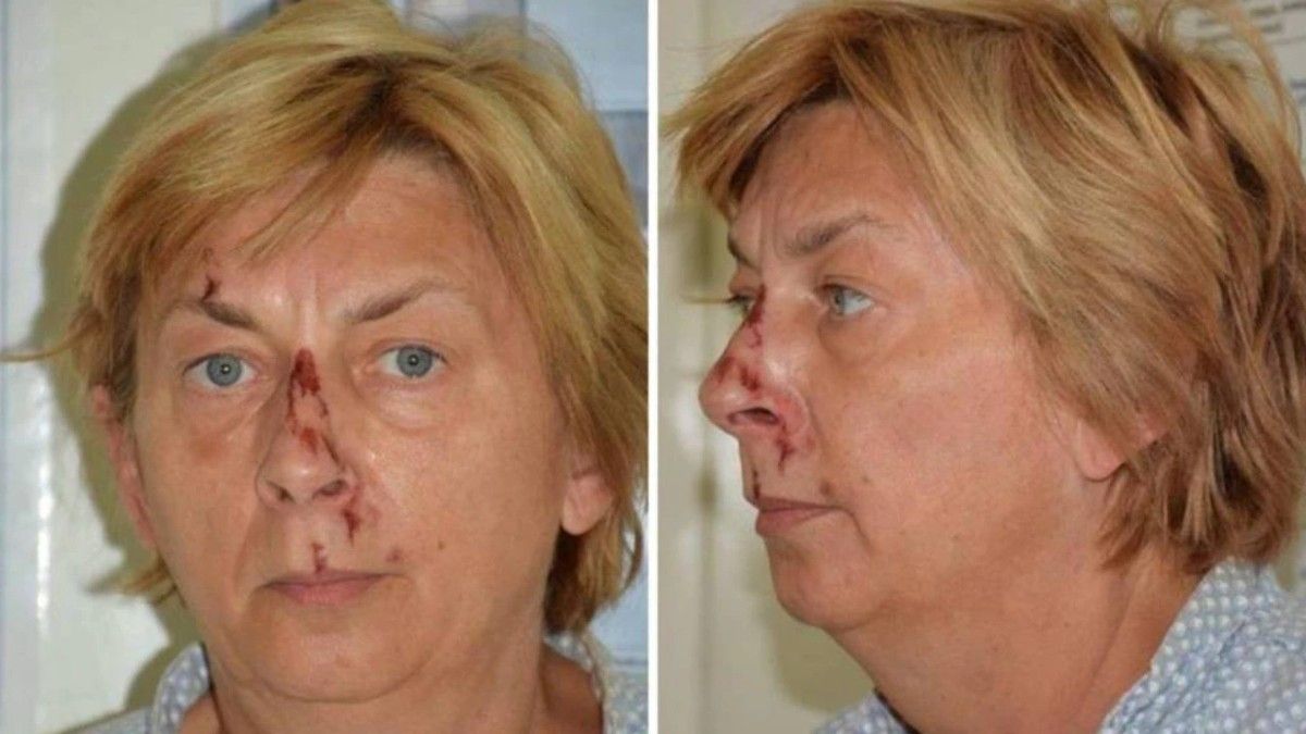 La mujer fue encontrada en zona rocosa de la isla de Krk