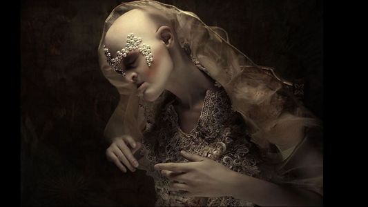 La modelo internacional con una mutación genética única