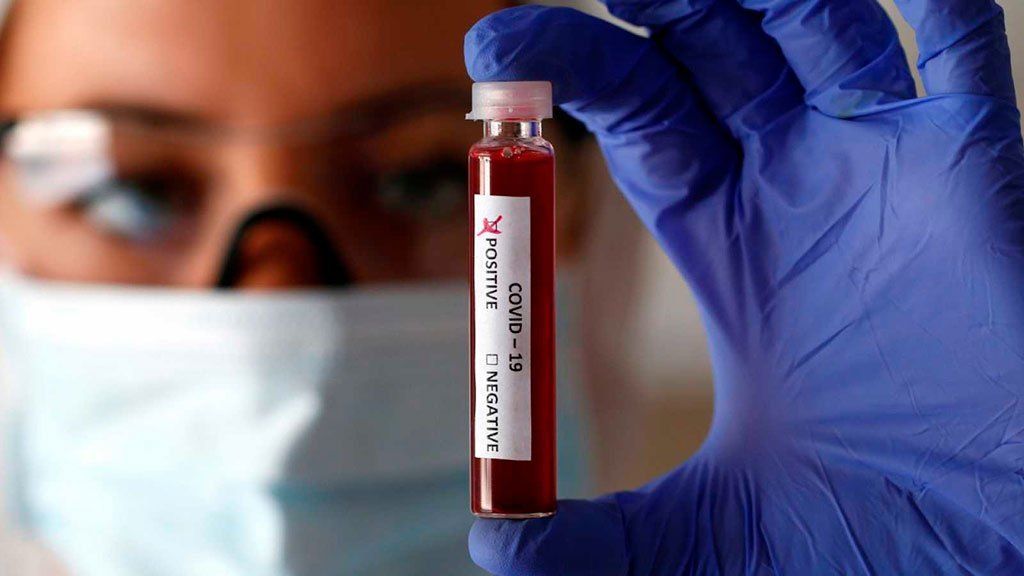 Con 134 nuevos casos, el total de infectados por coronavirus asciende a 5.020 y 264 fallecidos