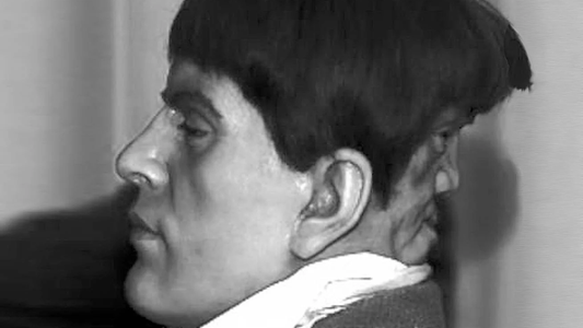 La historia de Edward Mordrake, el hombre con dos caras que desafió la medicina