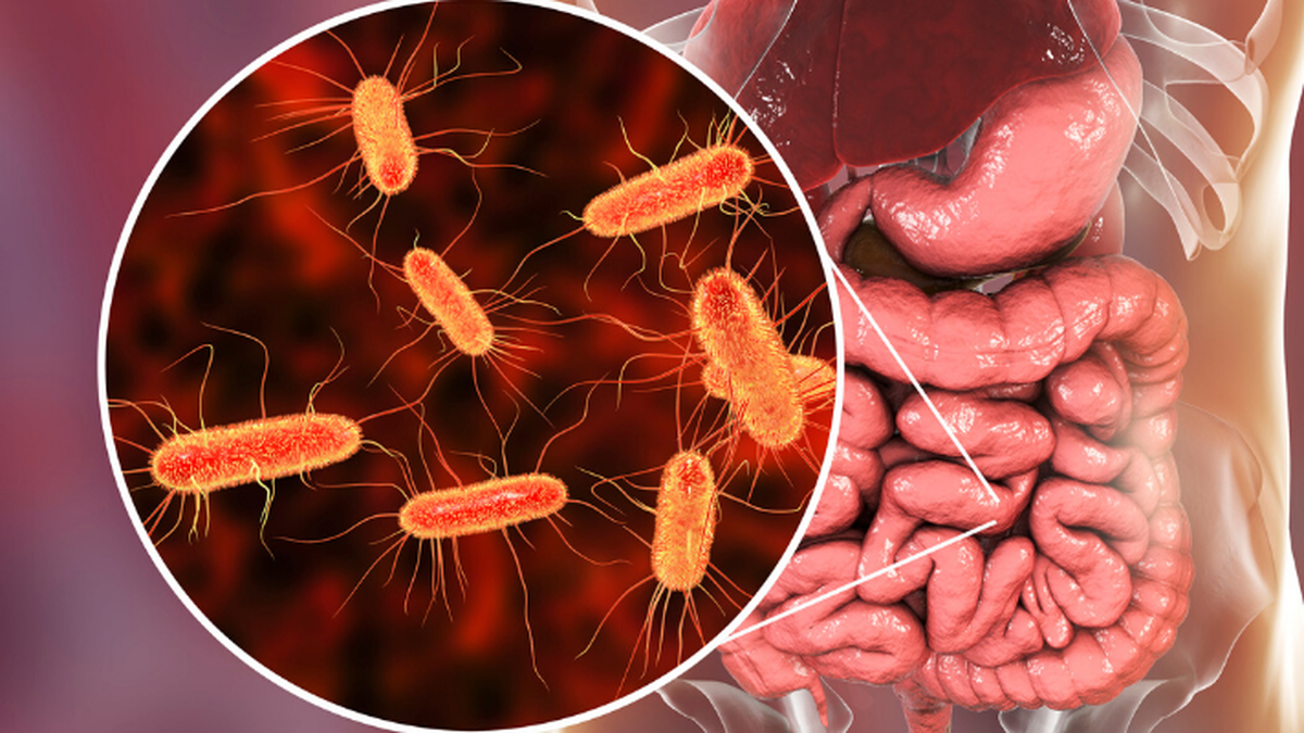 El Síndrome Urémico Hemolítico es una enfermedad grave que se origina a raíz de la Escherichia Coli, una bacteria que se aloja en el intestino de los animales de granja y que ataca principalmente a los riñones. (Foto: archivo)