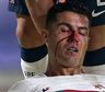 Cristiano Ronaldo sufrió un violento golpe y asustó a todos