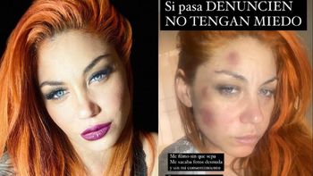 El nuevo mensaje de Lourdes de Bandana tras denunciar por violencia a su ex