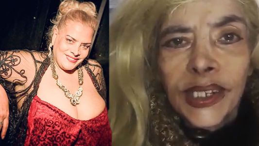 Preocupación por la salud de Lía Crucet tras un fuerte accidente doméstico