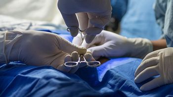 Se recomienda realizar un espermograma después de varias eyaculaciones para confirmar que la vasectomía fue efectiva.
