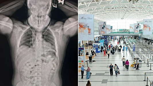 Detuvieron un hombre que quiso viajar a España con 84 cápsulas de cocaína en su estómago