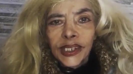 Lía Crucet sufrió un accidente doméstico y está internada