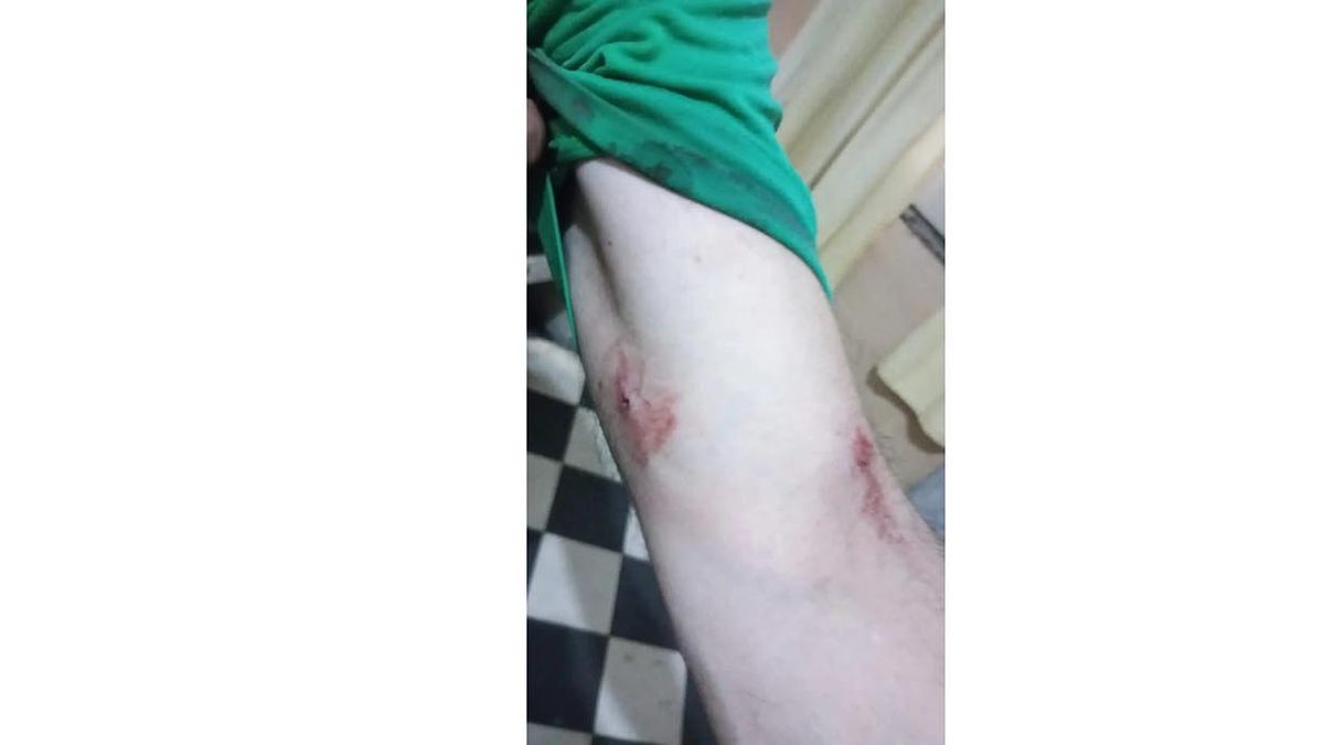 Sufri&oacute; un brote e intent&oacute; matar con un destornillador a su pap&aacute; en la ciudad de La Plata. (Foto: gentileza 0221)