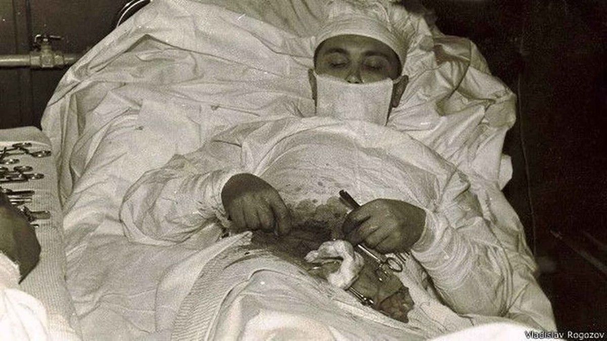Una decisión de vida o muerte. Leonid Rógozov fue el primer hombre que se operó a sí mismo del apéndice.&nbsp;