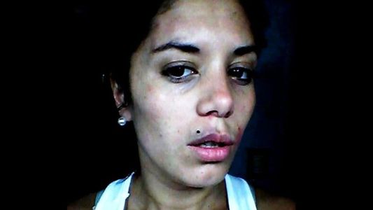 La verdad detrás de las fotos de la ex del Polaco con moretones: de cuándo son y cómo influyen en la causa