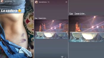 El video de la fuerte caída de Jimena Barón en el aquadance