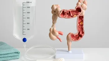 Limpieza de colon: qué es, qué riesgos tiene y cuándo puede ser necesaria