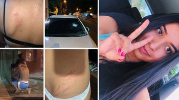 ¡Novia de Rodrigo Burgos defiende al jugador y acusa a su ex mujer de golpearla!